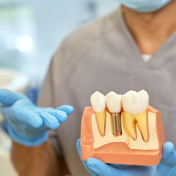 Reabilitação Oral com Implantes – Caso da Paciente Maria Alice