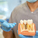 Reabilitação Oral com Implantes – Caso da Paciente Maria Alice
