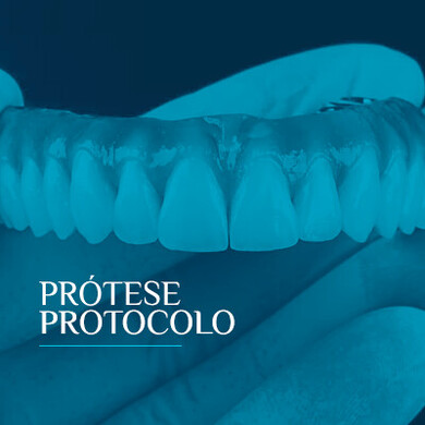 Prótese Protocolo